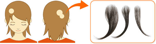 APLAN PARTIAL(アプランパーシャル)